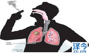 AZD9291可改善亚洲EGFR突变肺癌患者的无进展生存期