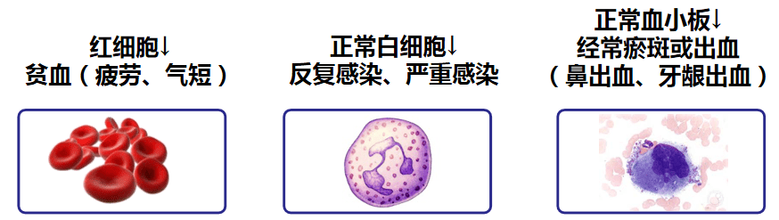 普纳替尼,Ponatinib
