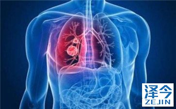 临床上AZD9291是如何治疗癌症的？