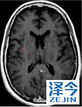 2019非小细胞肺癌患者将有哪些全新的治疗方案？