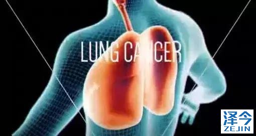 史上最全！肺癌靶点全面解读及对应靶向药物方案盘点！（2018）