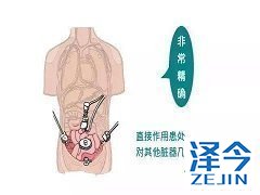 乐伐替尼治疗老年晚期甲状腺癌的临床特点