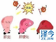 就价格来说哪一种乐伐替尼更适合患者？