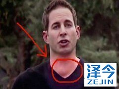 乐伐替尼的联合治疗效果如何？