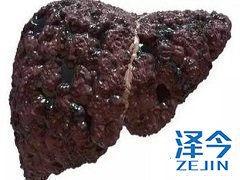 患者服用乐伐替尼出现胃口不好应如何解决？