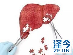 乐伐替尼可以和哪些药联合治疗？