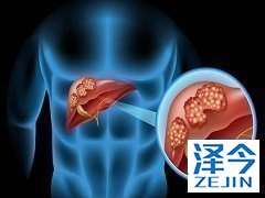 为什么孟加拉乐伐替尼更受患者欢迎？