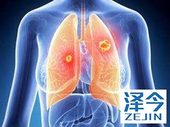 色瑞替尼作为二线用药对ALK重排NSCLC疗效怎么样？