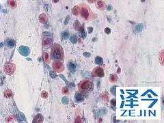 奥希替尼的药物相互作用