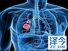 奥希替尼使用方法