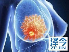 来那替尼扩展辅助治疗HER2乳腺癌存在副作用