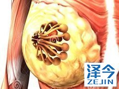 来那替尼能够基于曲妥珠单抗方案进行治疗