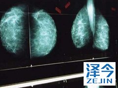 来那替尼的安全性和有效性是经过验证的