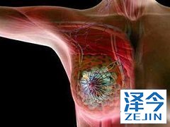 来那替尼有哪些优势 