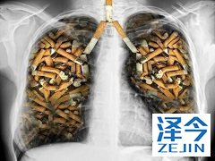 布加替尼能够治疗ALK+NSCLC患者吗