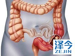 布加替尼联用其他药物使用剂量需要进行调整吗