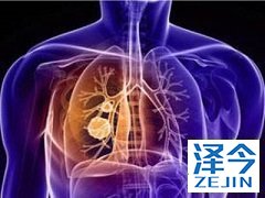 布加替尼因临床表现好获加速批准上市