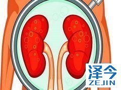 使用布加替尼时需减少食用高脂肪餐吗？