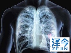 布加替尼在治疗的过程中表现出抗肿瘤活性