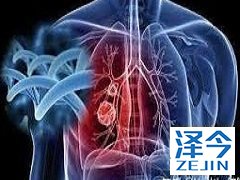 布加替尼在ALK重排的NSCLC中产生反应