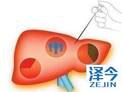 患者服用TAF时还要注意生活习惯!