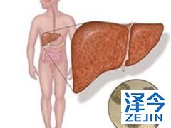 乙肝新药TAF能否克服干扰素带来的副作用？