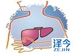 TAF具有的优点能否与它的价格成对等？