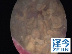 阿比特龙联合治疗具有抗肿瘤活性