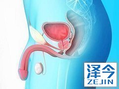 阿比特龙改善前列腺癌的生存期