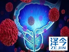 阿比特龙是前列腺癌患者的首选药物!