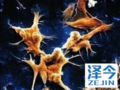 强生公司的阿比特龙新适应症？