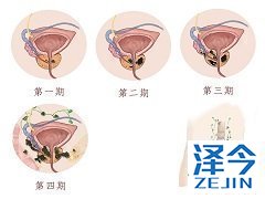 阿比特龙是强生出品的款重磅药物