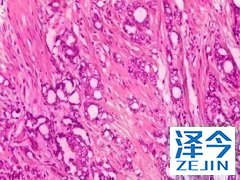 阿比特龙联合治疗的疗效和安全性如何？