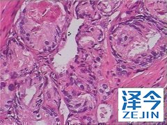 印度阿比特龙价格低的原因是？