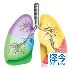 尼达尼布的注意事项有哪些？