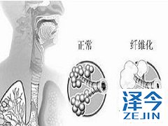 尼达尼布的使用详解