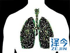 尼达尼布和肺癌靶向治疗的未来