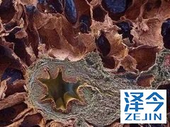 治疗特发性肺纤维化的药物尼达尼布的使用注意事项有哪些