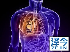 患者服用尼达尼布后可能会出现哪些不良反应