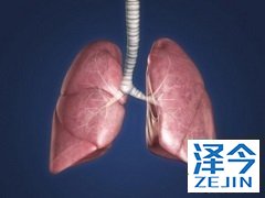 特效药尼达尼布你真的了解它吗?