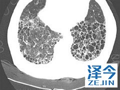 尼达尼布靶向药物抑制能够多种受体