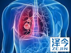 轻度肝损伤患者使用尼达尼布需要注意什么