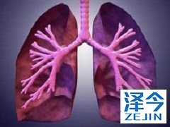 使用尼达尼布的注意事项说明