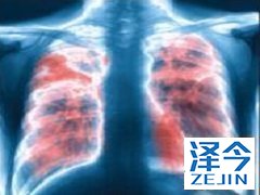 患者在使用尼达尼布之后能够延长生存期