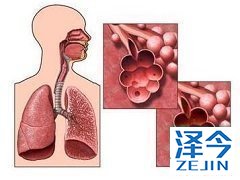 尼达尼布与西地那非治疗特发性肺纤维化患者