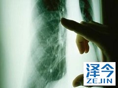 使用尼达尼布作为肺腺癌二线治疗效果好吗？