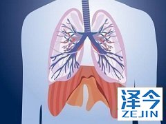 使用尼达尼布的IPF患者能够降低死亡的风险