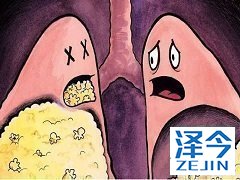 新研究强调了尼达尼布在IPF治疗中的益处