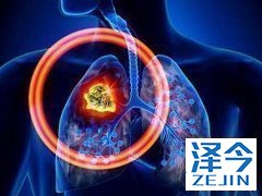 尼达尼布有哪时治疗方案能够使用