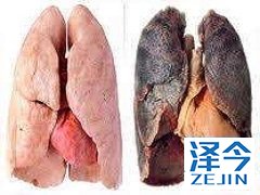 尼达尼布(CYENDIV)对于肺纤维化患者的治疗有影响吗